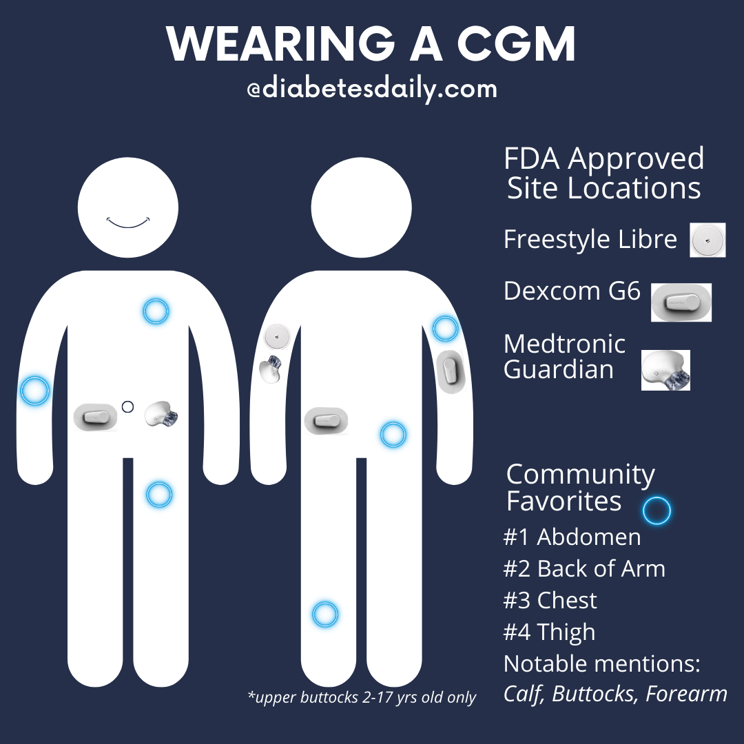 Using Libra 2 Sensor: What Bones Are Approved and Why?